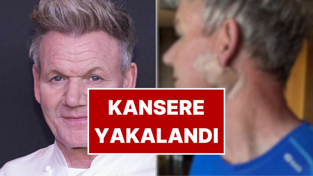 Dünyaca Ünlü Şef Gordon Ramsay'den Sevenlerini Üzen Haber: Kansere Yakalandığını Duyurdu! 10 dunyaca unlu sef gordon ramsayden sevenlerini uzen haber kansere yakalandigini duyurdu Qn7rufG2