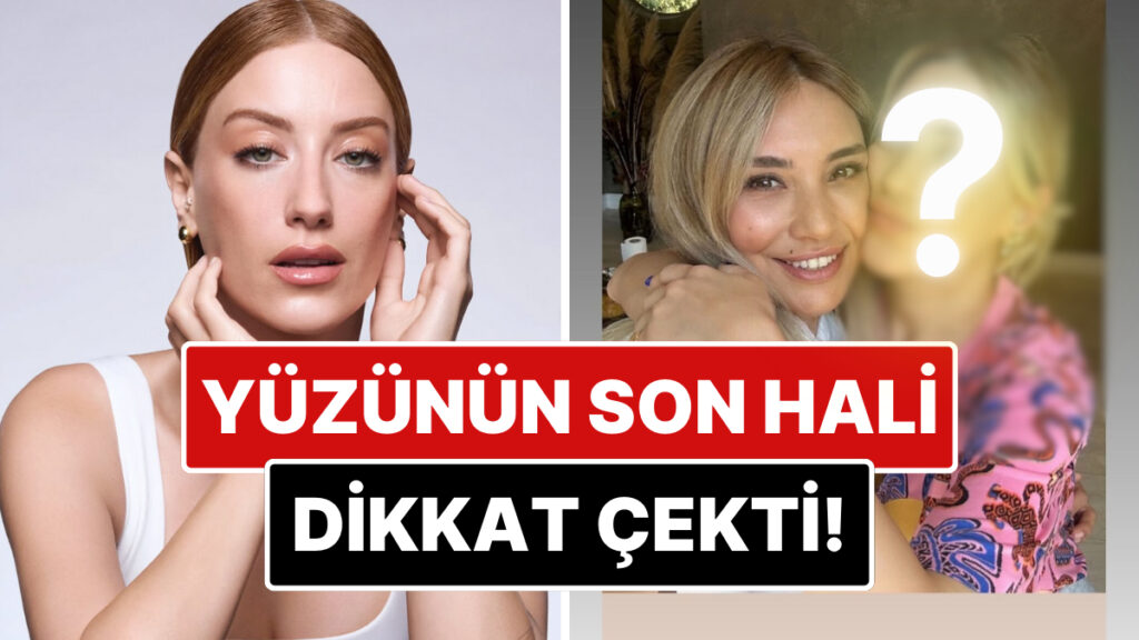 estetik mi yaptirdi bir guzellik merkezinden paylasim yapan hazal kayanin yuzundeki degisim dikkat cekti mBz87KbA