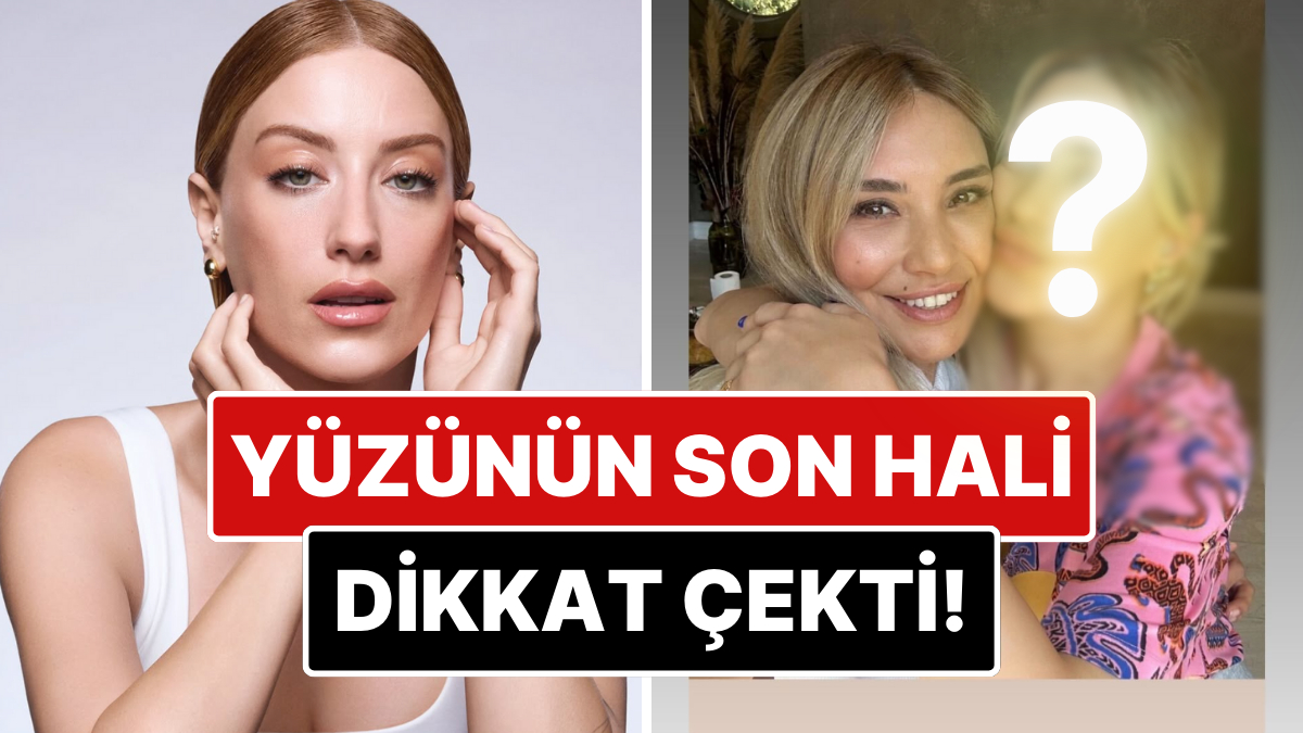 estetik mi yaptirdi bir guzellik merkezinden paylasim yapan hazal kayanin yuzundeki degisim dikkat cekti mBz87KbA