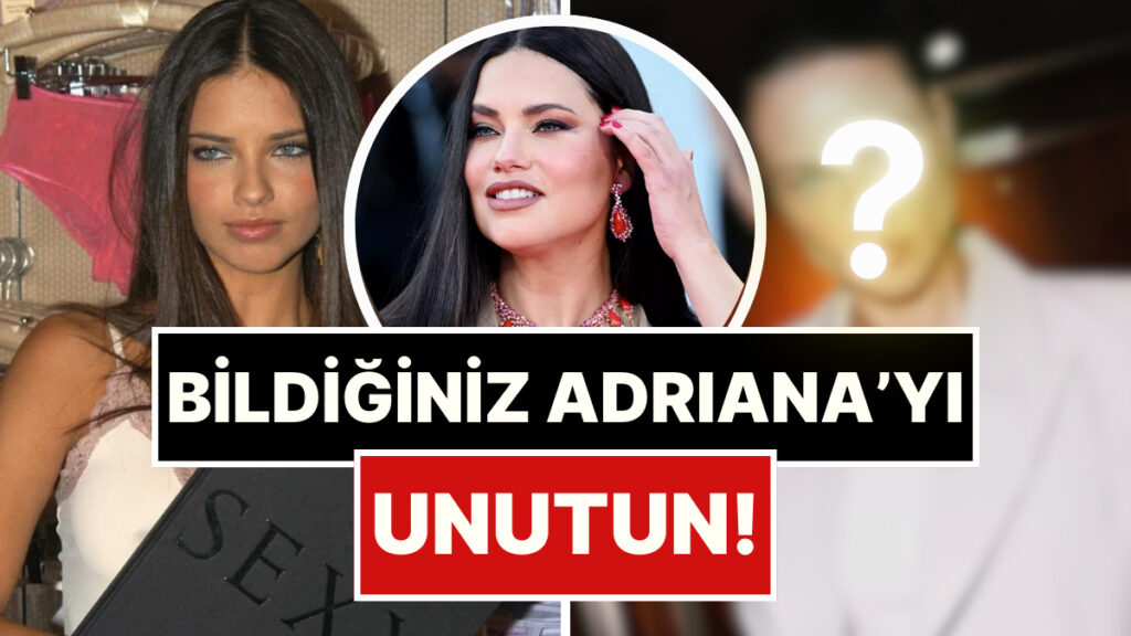 insan kendine bunu yapar mi yuz yaglarini aldiran adriana limanin son hali soklardan soklara 3XIWhrml