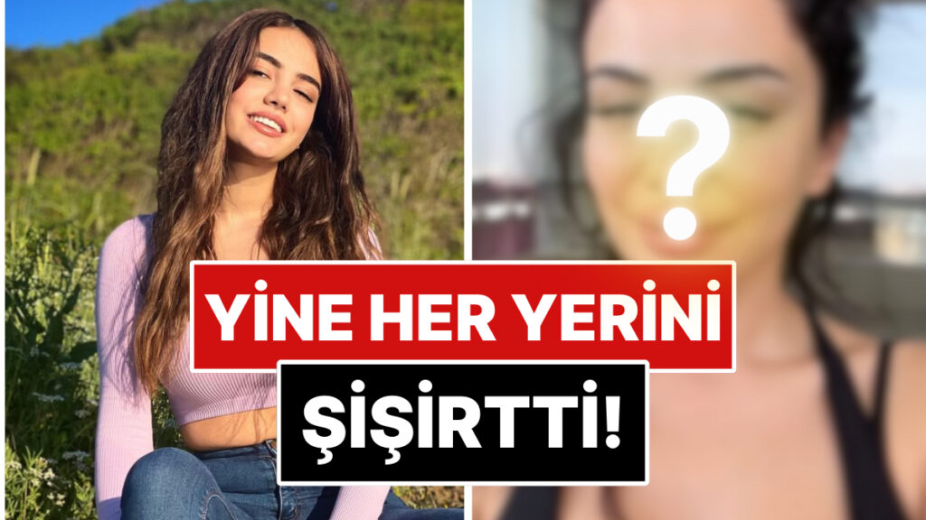 Oyunculuk Hayaliyle Estetiklerini Eriten Ece Ronay, Umduğunu Bulamayınca Yüzünü Sil Baştan Bir Daha Yaptırdı! 7 oyunculuk hayaliyle estetiklerini eriten ece ronay umdugunu bulamayinca yuzunu sil bastan bir daha yaptirdi sHsUGGfx