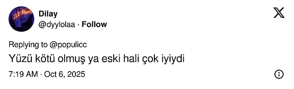 Paris Moda Haftası'na Katılan 'Wednesday' Jenna Ortega'nın Yüzünün Son Hali Şoka Soktu! 6 paris moda haftasina katilan wednesday jenna orteganin yuzunun son hali soka soktu 5