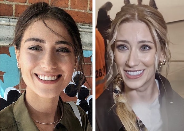 dislerine yaptirdigi islemle taninmaz hale gelen hazal kayadan radikal karar 0 jDtRkfcA