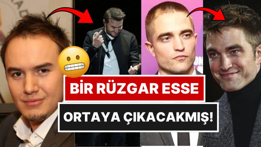 eski hallerini gorunce bi miktar sok olacaginiz protez sacli unluler sizIZjPN