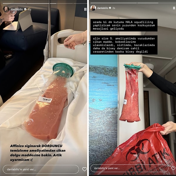 Yanlış Operasyon Sebebiyle Vücudundan Kilolarca Dolgu Çıkan Danla Bilic 6. Kez Ameliyat Olacağını Duyurdu 2 yanlis operasyon sebebiyle vucudundan kilolarca dolgu cikan danla bilic 6 kez ameliyat olacagini duyurdu eGvdjEAm