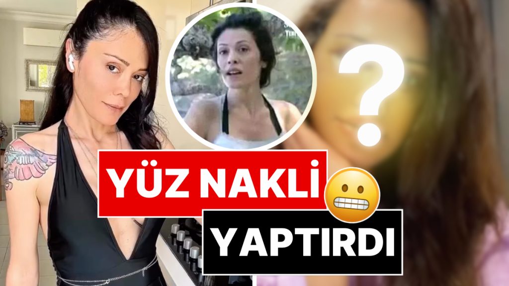 eski survivor yarismacisi didem ceran korede yuz nakli yaptirdi Ty1ah487