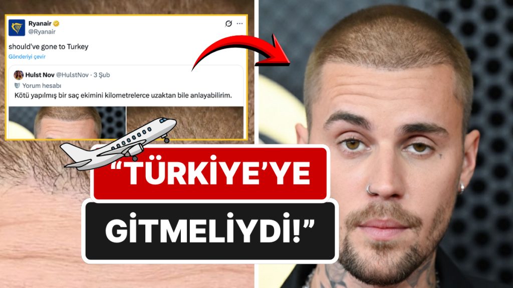 Saç Ekimi Başarısız Geçen Justin Bieber'a Ünlü Hava Yolu Şirketinden Türkiye Göndermesi 3 sac ekimi basarisiz gecen justin biebera unlu hava yolu sirketinden turkiye gondermesi 27wHxm6t